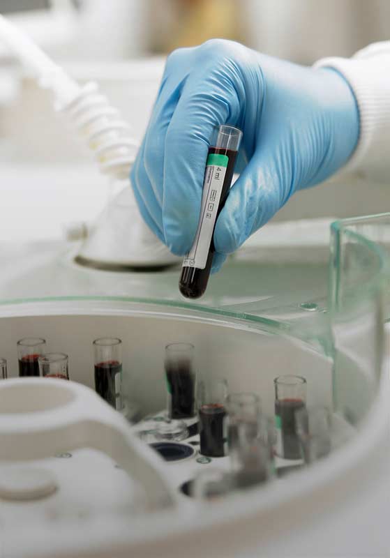 Exámenes hematológicos – Laboratorio San Andrés