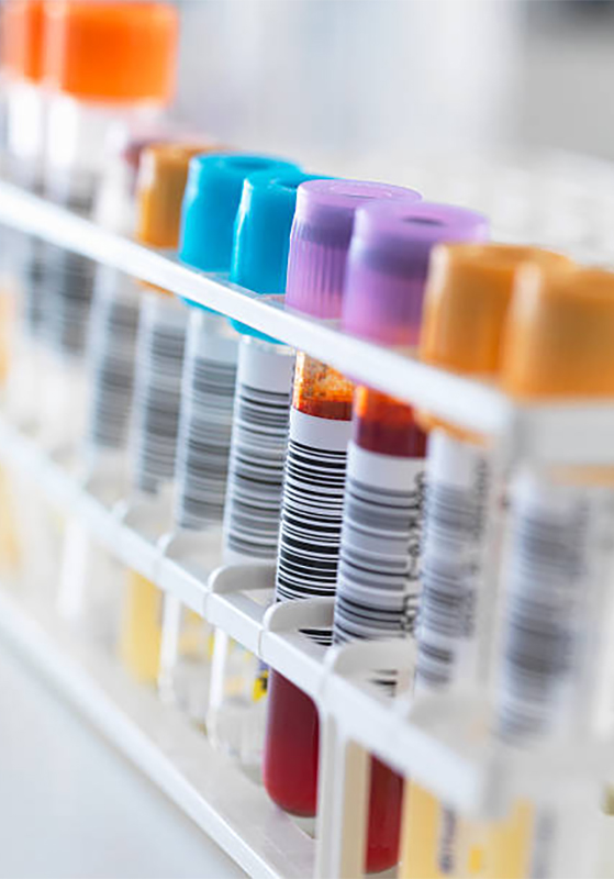 Exámenes Virales – Laboratorio San Andrés